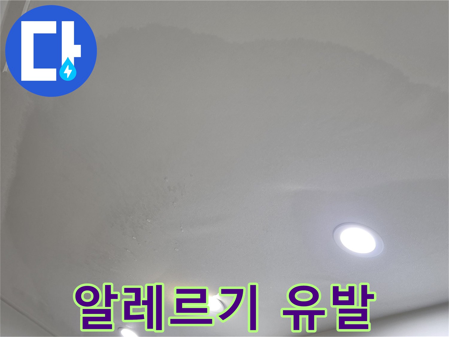 양주 아파트 누수 - 곰팡이 핀 천장, 알레르기