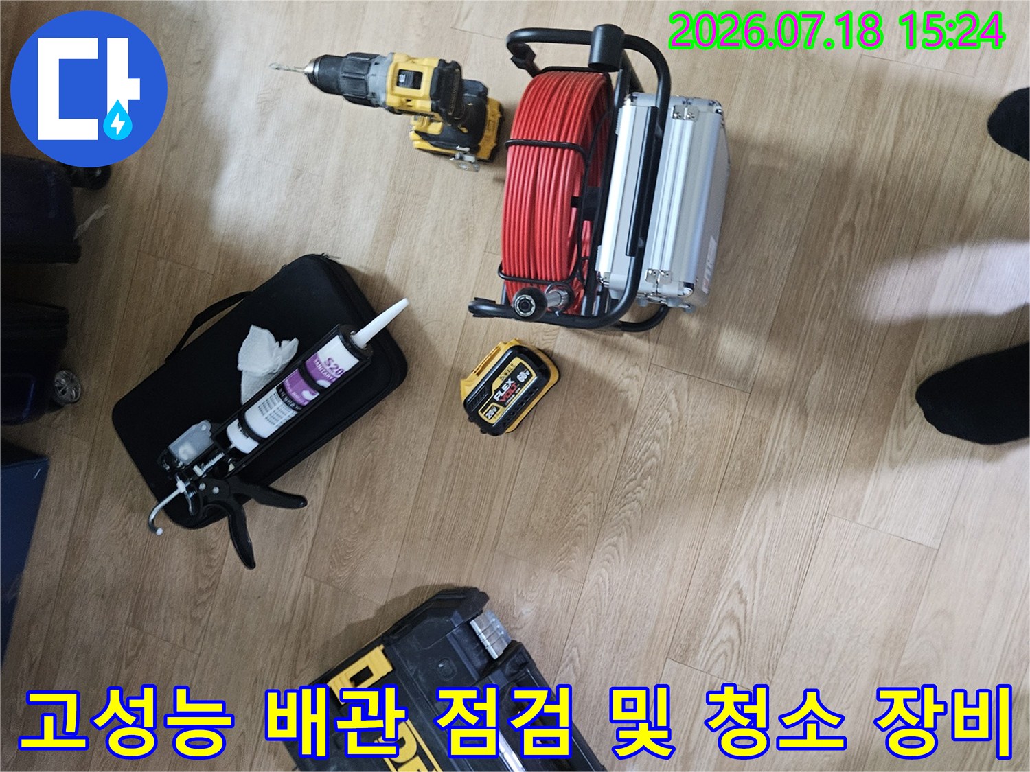 내시경장비와 스케일링 호스 그리고 전문 공구함의 구성